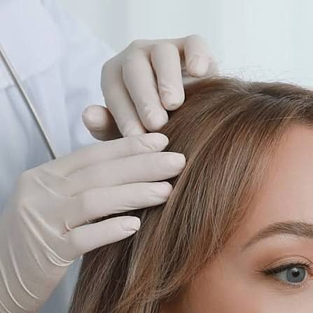 Exame do couro cabeludo, com o cabelo separado por mecha