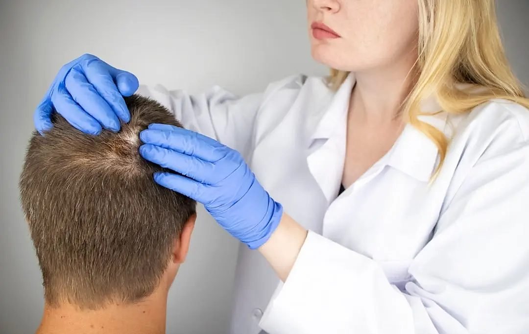 Exame do couro cabeludo com tricoscópio, em consultório